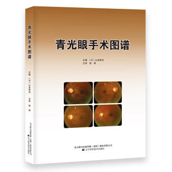  青光眼手术图谱  商品图0