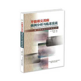 牙髓根尖周病病例分析与临床实战：基于根管形态的治疗疾病策略选择 