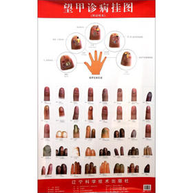 望甲诊病挂图(附说明书) 