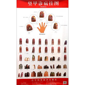  望甲诊病挂图(附说明书)  商品图0
