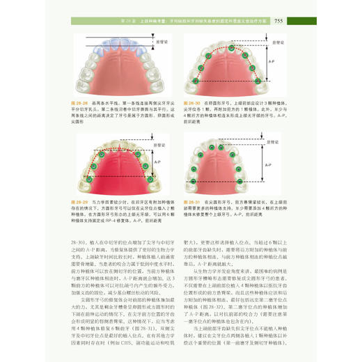 口腔种植修复学下卷 商品图4