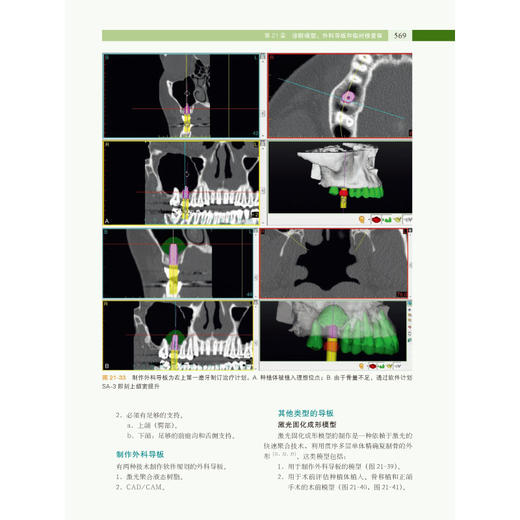 口腔种植修复学下卷 商品图3