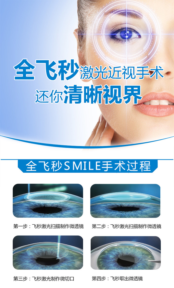 全飛秒smile手術抵用券(術前檢查 1000元手術抵用券 全國免費終身術後