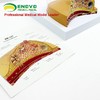 现货速发【医教模型】ENOVO颐诺乳房病理解剖模型乳房模型 商品缩略图3