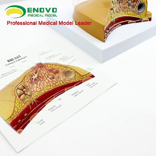 现货速发【医教模型】ENOVO颐诺乳房病理解剖模型乳房模型 商品图3