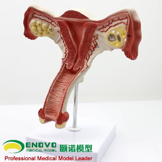 现货速发【医教模型】颐诺人体医学女性子宫模型卵巢生殖结构解剖模型妇科妇产科 商品图2