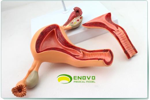 现货速发【医教模型】ENOVO颐诺医学 女性内生殖器官模型子宫卵巢生殖结构妇产科模型 子宫模型 妇科教学 妇科检查生殖健康教学 商品图2