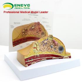 现货速发【医教模型】ENOVO颐诺乳房病理解剖模型乳房模型
