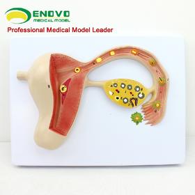 现货速发【医教模型】ENOVO颐诺人体受精卵模型妊娠胚胎儿发育过程子宫组织胚胎模型