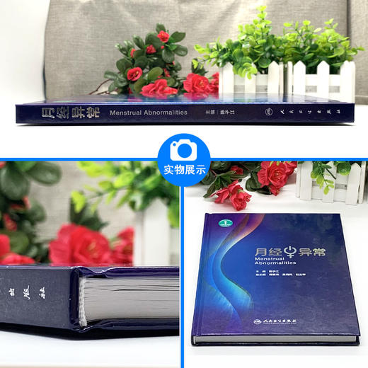 月经异常 陈子江主编 人民卫生出版社 妇科 9787117282574 2019年3月参考书 商品图1