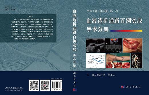 血液透析通路百例实战. 手术分册/郁正亚 谭正力 商品图3