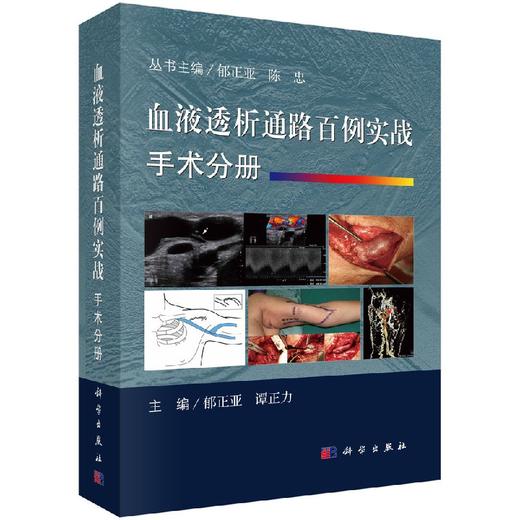 血液透析通路百例实战. 手术分册/郁正亚 谭正力 商品图0