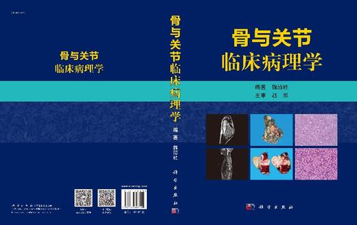 骨与关节临床病理学/魏清柱 商品图3