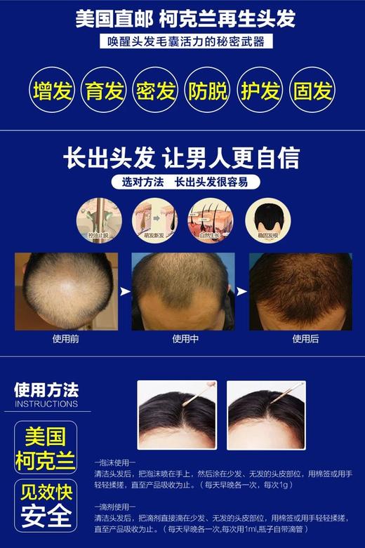 KirkLand可兰 Minoxidil 生发水 米*地尔男性泡沫 6瓶装*60g，美国代购，无中文标签，介意慎拍 商品图3