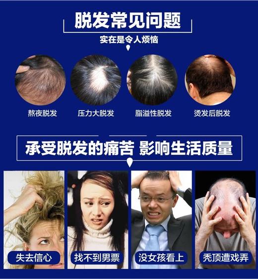 KirkLand可兰 Minoxidil 生发水 米*地尔男性泡沫 6瓶装*60g，美国代购，无中文标签，介意慎拍 商品图4