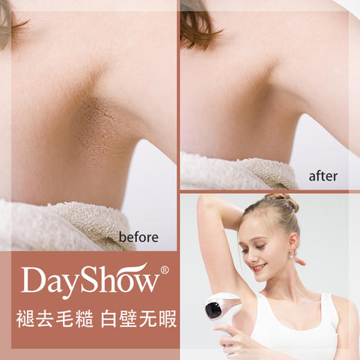 DayShow 双冰感脱毛仪  舒适脱毛不伤肤 商品图5