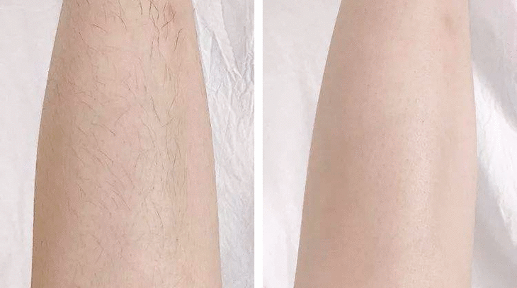 淑魅儿脱毛喷雾 | 一喷一擦,8分钟无痛脱毛