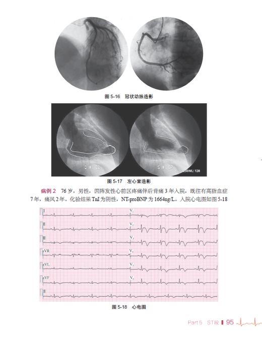 心电解惑 商品图1