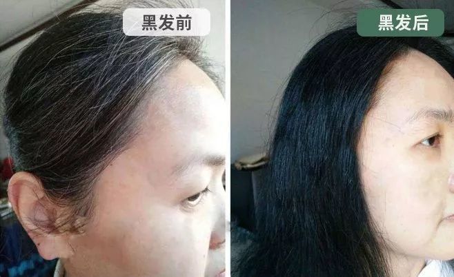 桑葚黑发液 | 白发轻松变黑发,乌帝科帝