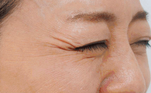 【秒杀】binwan铜离子美颜眼罩 | 眼纹小熨斗,睡一