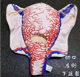 顺丰速发【医教模型】现货：切口左侧下延裂——妊娠子宫二维血管构造软体模型