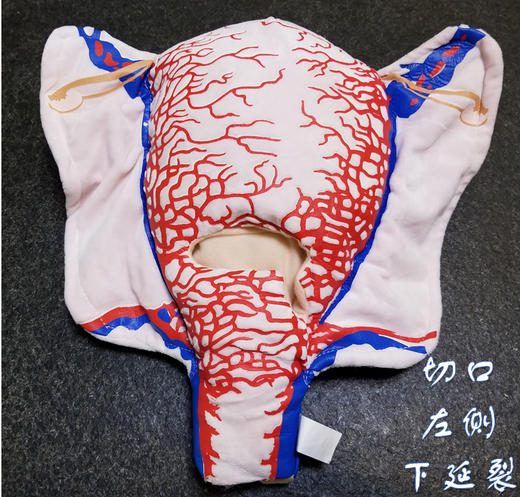 顺丰速发【医教模型】现货：切口左侧下延裂——妊娠子宫二维血管构造软体模型 商品图0