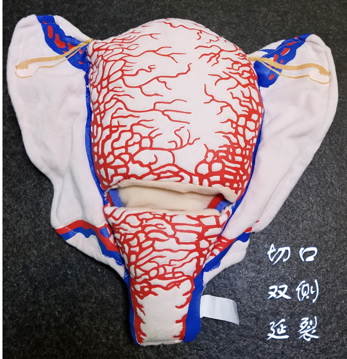 顺丰速发【医教模型】现货：切口双侧延裂——妊娠子宫二维血管构造软体模型