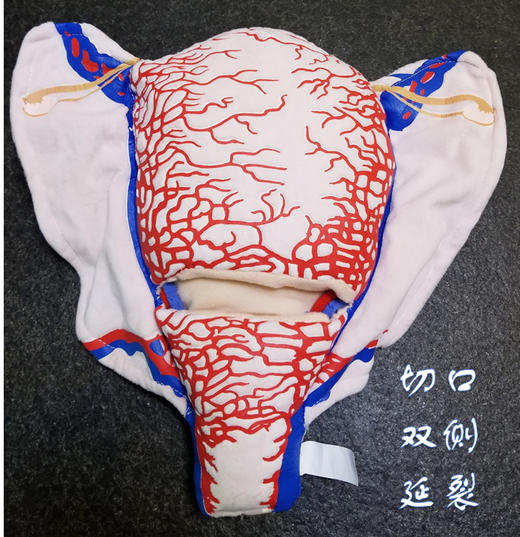 顺丰速发【医教模型】现货：切口双侧延裂——妊娠子宫二维血管构造软体模型 商品图0