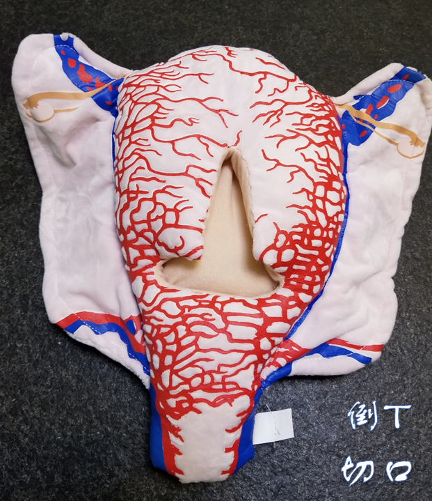 顺丰速发【医教模型】现货： 倒T切口型——妊娠子宫二维血管构造软体模型