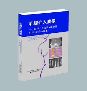 《乳腺介入成像——超声、X线及MRI影像引导下的介入技术》