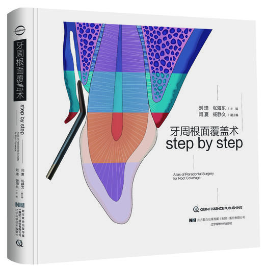 《牙周根面覆盖术》 商品图0