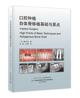 《口腔种植自体骨移植基础与要点》