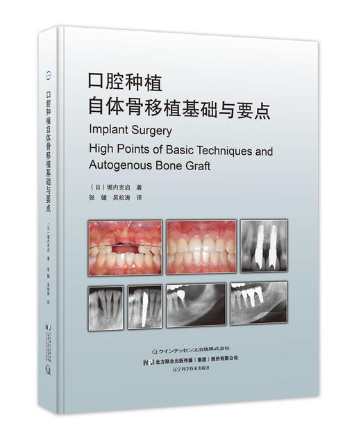 《口腔种植自体骨移植基础与要点》 商品图0