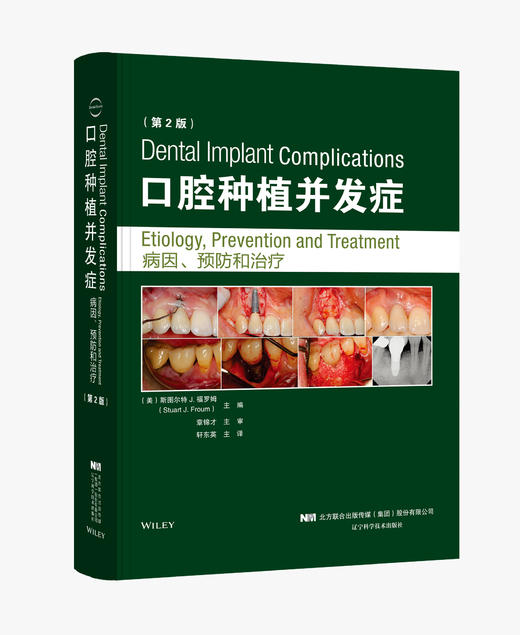 《口腔种植并发症 病因、预防和治疗（第2版）》 商品图0