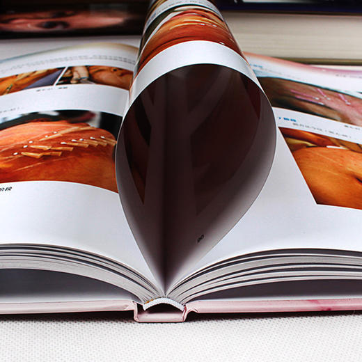 埋线提升与抗衰老操作手册（分类：埋线书籍） 商品图3