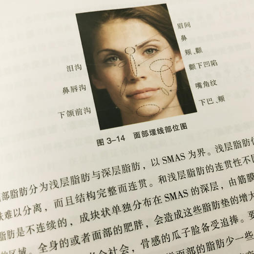 穴位埋线美容资料集：埋线美容塑形（分类：埋线书籍） 商品图4