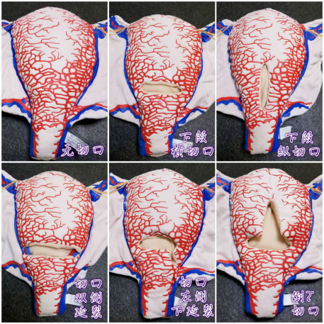 【顺丰速发】6种现货：妊娠子宫二维血管构造软体模型（多切口可选）