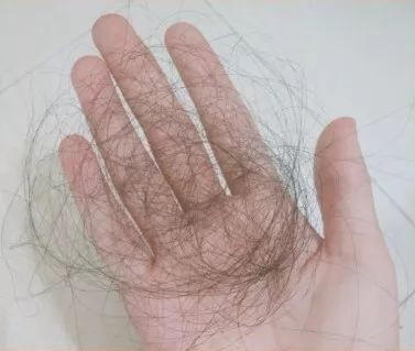 脱发已成为国民焦虑，你的头发还好吗？ 商品图0