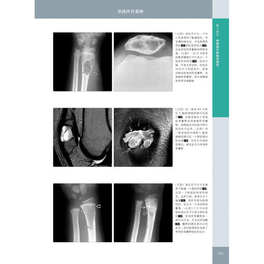 《骨肌影像诊断学（非创伤性疾病）（原著第 2 版）》——国际经典影像诊断学丛书 商品图4