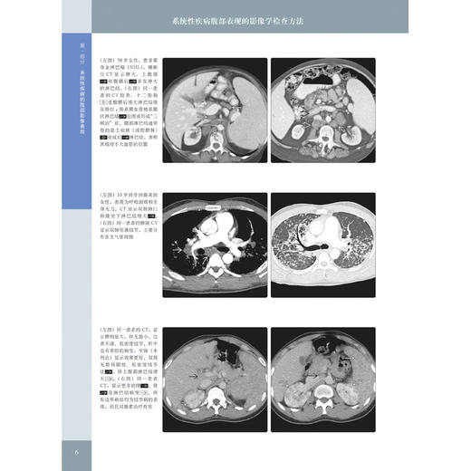 《消化影像诊断学（原著第3版）》—— “国际经典影像诊断学丛书” 商品图3
