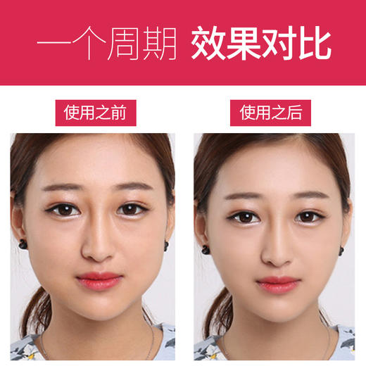 补水面膜御美芝v脸面膜神器提拉紧致面膜挂耳式小v脸贴水凝胶冷敷贴