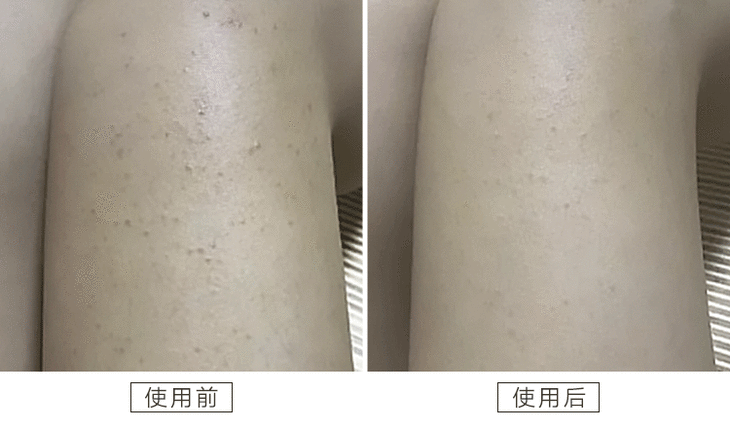 鸡皮皮肤素材(鸡皮皮肤怎么弄)