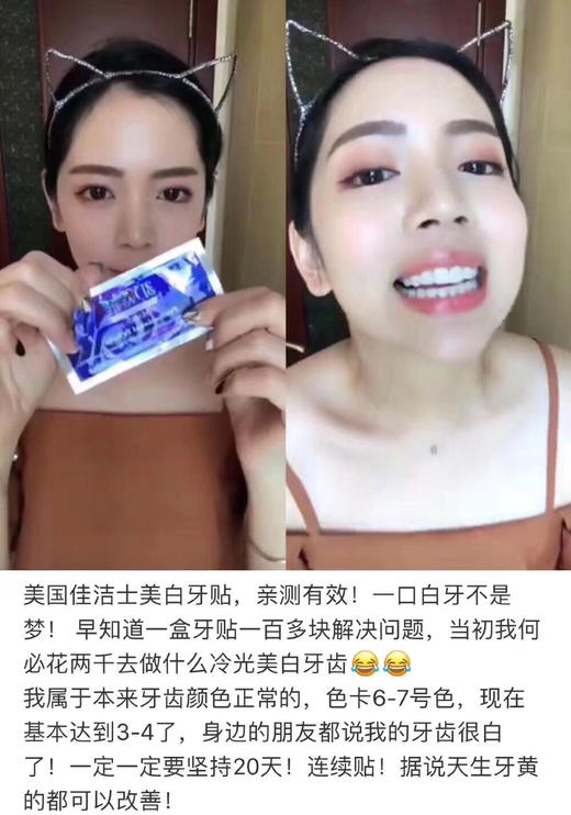 永别了大黄牙！Crest美白牙贴2盒超值装 商品图3