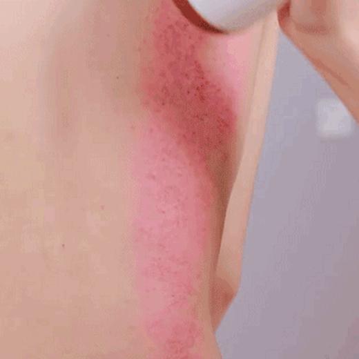 【经络不通，血管太硬，疾病排着队来找你！】砭石温灸仪 ，便携刮痧、热敷、推拿 商品图1