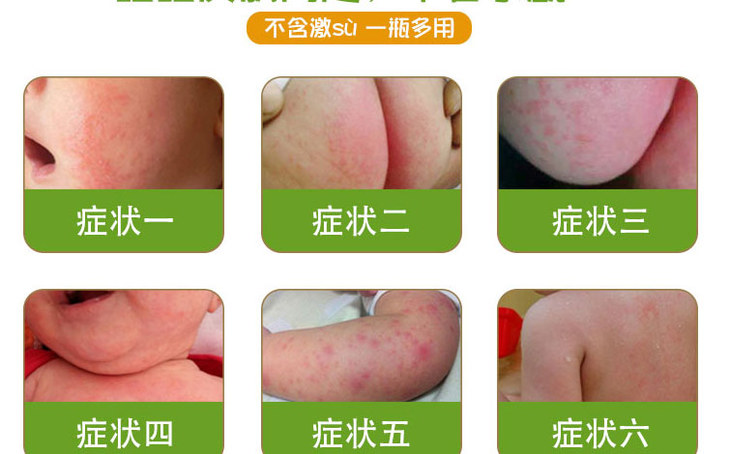 仲景春草婴儿春草护臀膏30g