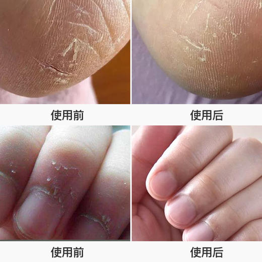 草本滋润香樟乳霜 | 抹一抹滋润不油腻，缓解皮肤干裂、脱皮 英格莱恩ingram's 商品图4