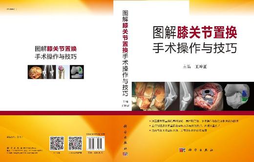 图解膝关节置换手术操作与技巧/王坤正 商品图3