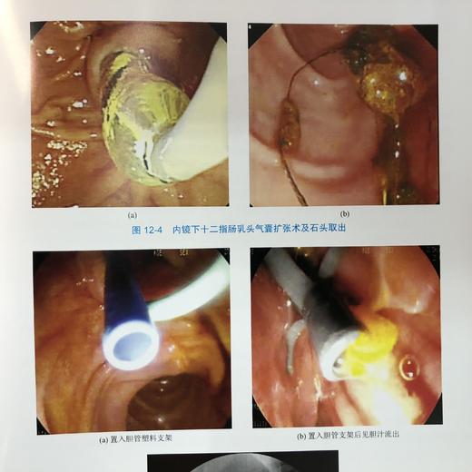 实用急诊消化内镜技术 商品图3