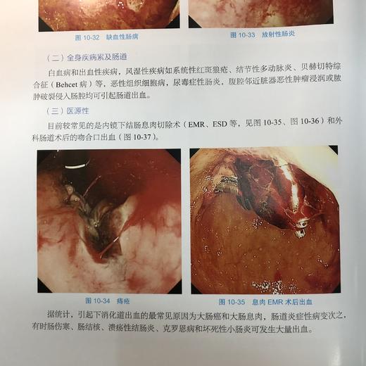 实用急诊消化内镜技术 商品图2