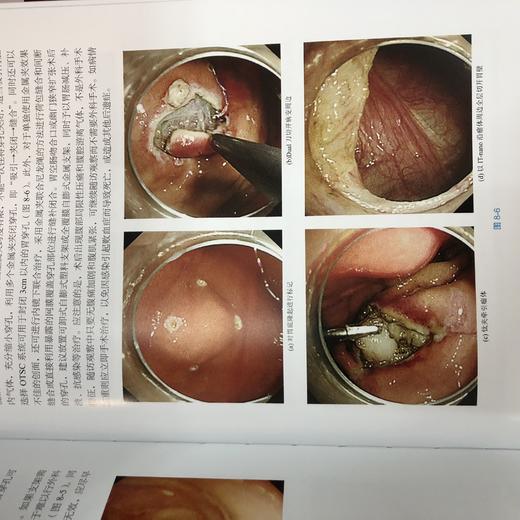 实用急诊消化内镜技术 商品图4